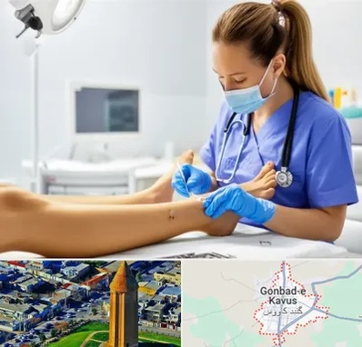 کارشناس زخم در گنبد کاووس