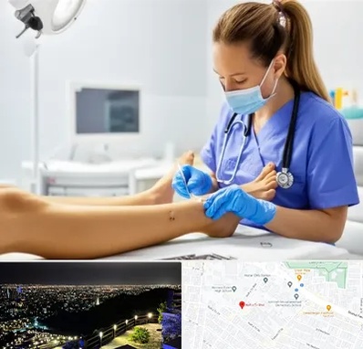 کارشناس زخم در هفت تیر مشهد 