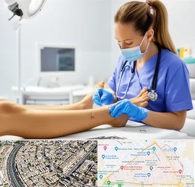 کارشناس زخم در شهرک غرب مشهد 