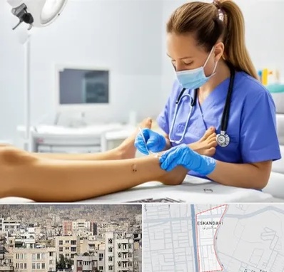 کارشناس زخم در اسکندری 