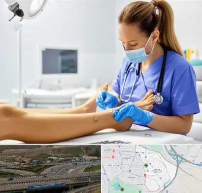 کارشناس زخم در یاغچیان تبریز 