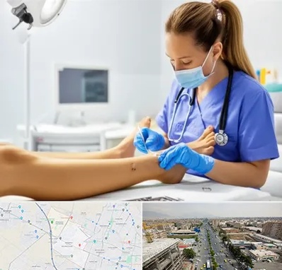 کارشناس زخم در حصارک کرج 