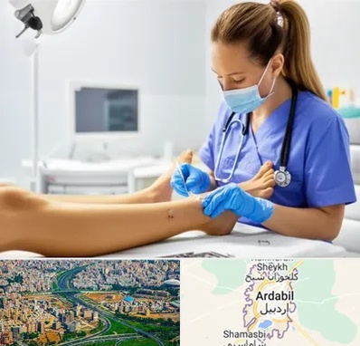 کارشناس زخم در اردبیل