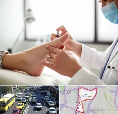 متخصص زخم دیابت در امیرآباد