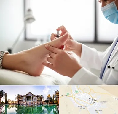 متخصص زخم دیابت در شیراز