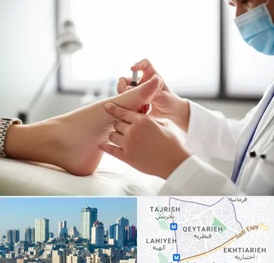 متخصص زخم دیابت در قیطریه 
