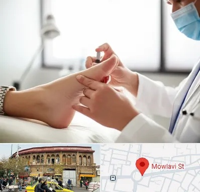 متخصص زخم دیابت در مولوی