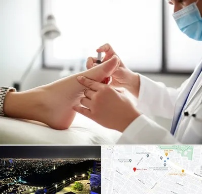 متخصص زخم دیابت در هفت تیر مشهد 