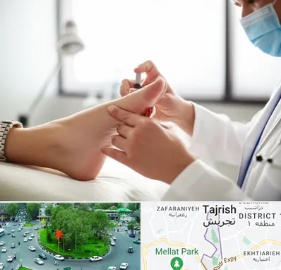 متخصص زخم دیابت در تجریش 