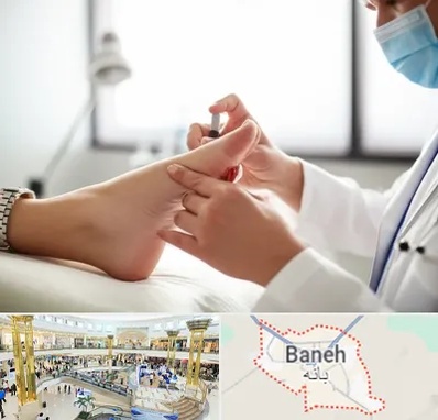 متخصص زخم دیابت در بانه