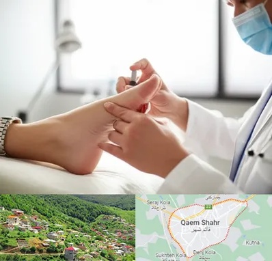 متخصص زخم دیابت در قائم شهر
