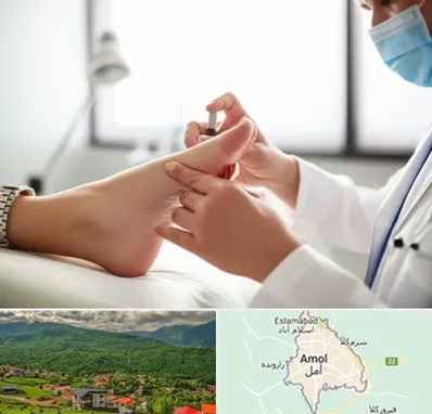 متخصص زخم دیابت در آمل