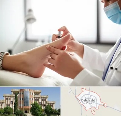 متخصص زخم دیابت در دهدشت