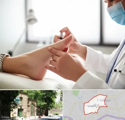متخصص زخم دیابت در دزاشیب