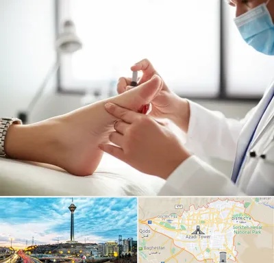 متخصص زخم دیابت در تهران