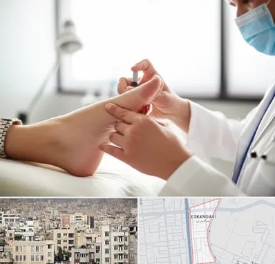 متخصص زخم دیابت در اسکندری
