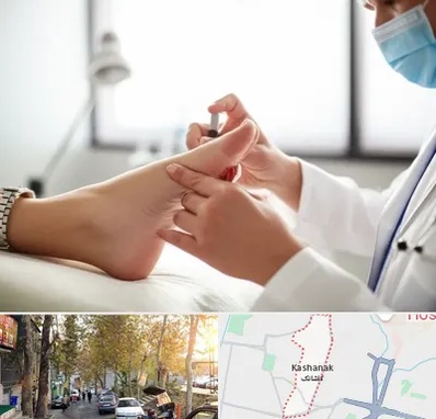 متخصص زخم دیابت در کاشانک