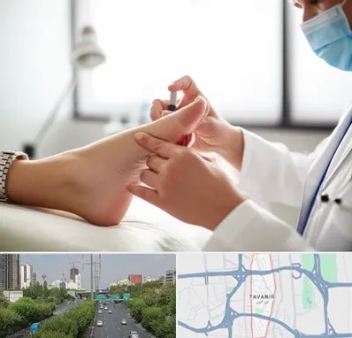 متخصص زخم دیابت در توانیر 
