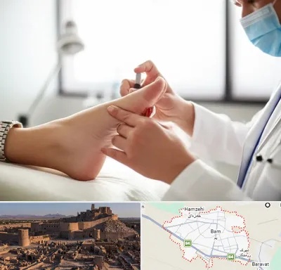 متخصص زخم دیابت در بم