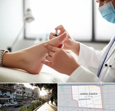 متخصص زخم دیابت در خیابان جمالزاده