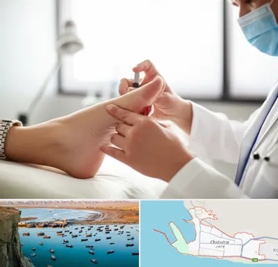 متخصص زخم دیابت در چابهار