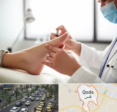 متخصص زخم دیابت در شهر قدس