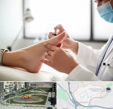 متخصص زخم دیابت در مرزداران تبریز 