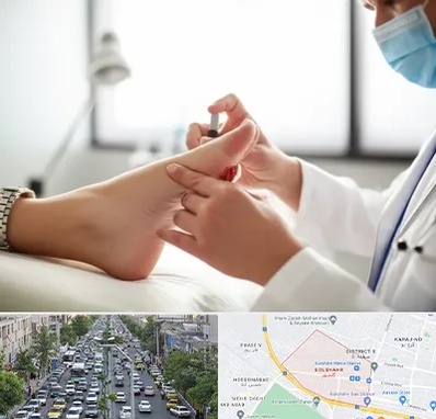 متخصص زخم دیابت در گلشهر کرج 