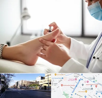 متخصص زخم دیابت در خیابان ملاصدرا شیراز 