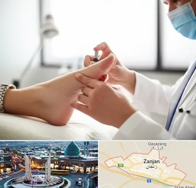 متخصص زخم دیابت در زنجان