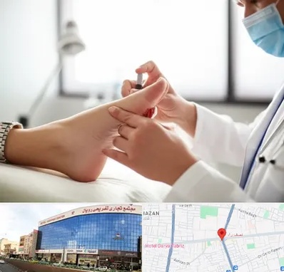 متخصص زخم دیابت در نصف راه تبریز 