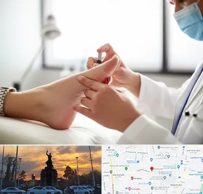 متخصص زخم دیابت در میدان حر 