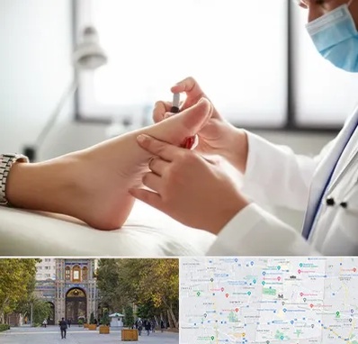 متخصص زخم دیابت در منطقه 12 تهران 