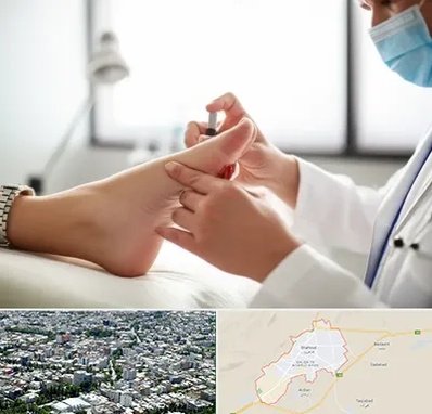 متخصص زخم دیابت در شاهرود