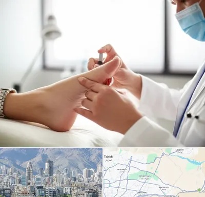 متخصص زخم دیابت در شمال شرق تهران