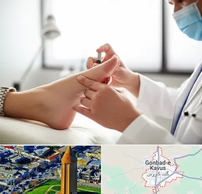 متخصص زخم دیابت در گنبد کاووس