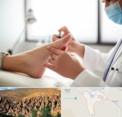 متخصص زخم دیابت در اسکو