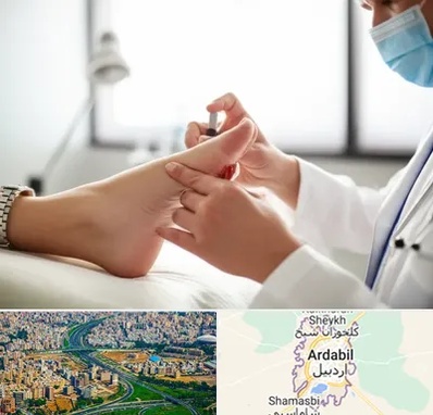 متخصص زخم دیابت در اردبیل