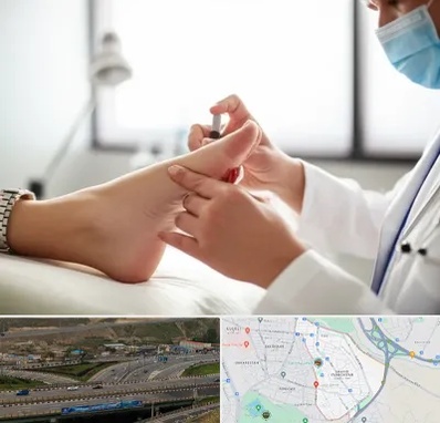 متخصص زخم دیابت در یاغچیان تبریز 