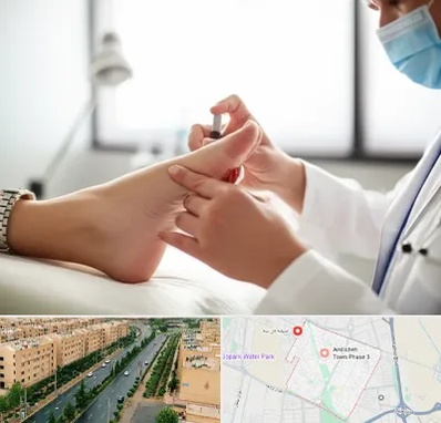 متخصص زخم دیابت در فاز سه اندیشه