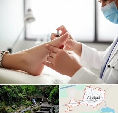 متخصص زخم دیابت در علی آباد کتول