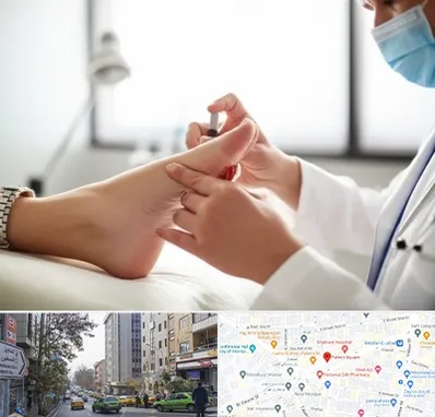 متخصص زخم دیابت در فاطمی
