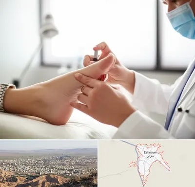 متخصص زخم دیابت در اسفراین