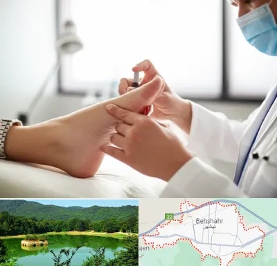 متخصص زخم دیابت در بهشهر