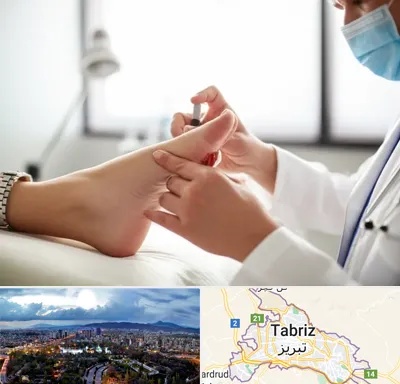 متخصص زخم دیابت در تبریز