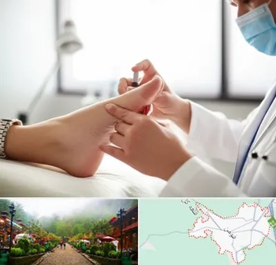 متخصص زخم دیابت در فومن