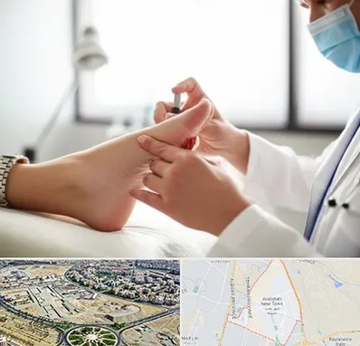 متخصص زخم دیابت در اندیشه