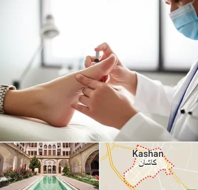 متخصص زخم دیابت در کاشان