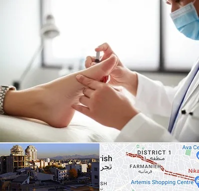 متخصص زخم دیابت در فرمانیه 