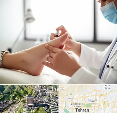 متخصص زخم دیابت در شمال تهران 